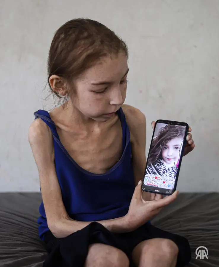 I bambini a Gaza stanno morendo di fame? Chiedi a Grok I bambini a Gaza stanno morendo di fame? Chiedi a Grok