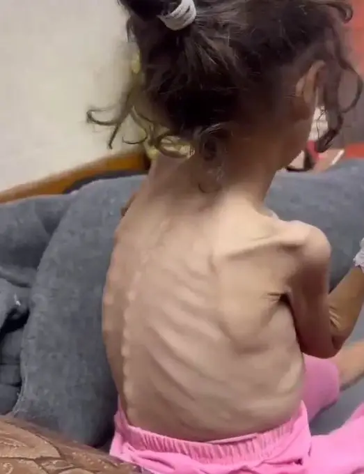 I bambini a Gaza stanno morendo di fame? Chiedi a Grok I bambini a Gaza stanno morendo di fame? Chiedi a Grok